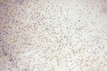 RBM3 Antibody in Immunohistochemistry (Paraffin) (IHC (P))