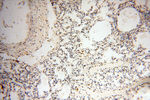 RBM3 Antibody in Immunohistochemistry (Paraffin) (IHC (P))