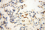 RBM3 Antibody in Immunohistochemistry (Paraffin) (IHC (P))