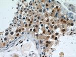 RBM3 Antibody in Immunohistochemistry (Paraffin) (IHC (P))