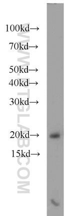 RBM3 Antibody in Western Blot (WB)