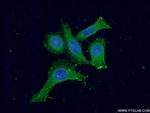 PKC gamma Antibody in Immunocytochemistry (ICC/IF)