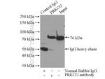 PKC gamma Antibody in Immunoprecipitation (IP)