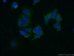 FAM175A Antibody in Immunocytochemistry (ICC/IF)