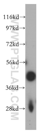 FAM175A Antibody in Western Blot (WB)