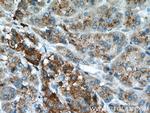 GAA Antibody in Immunohistochemistry (Paraffin) (IHC (P))