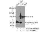 GAA Antibody in Immunoprecipitation (IP)