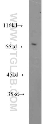 GAA Antibody in Western Blot (WB)