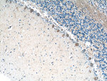 MTMR2 Antibody in Immunohistochemistry (Paraffin) (IHC (P))