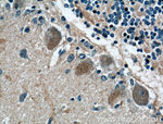 MTMR2 Antibody in Immunohistochemistry (Paraffin) (IHC (P))