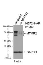 MTMR2 Antibody in Western Blot (WB)