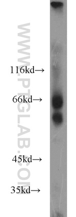 MTMR2 Antibody in Western Blot (WB)