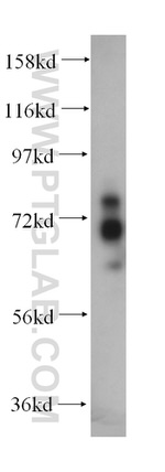 MTMR2 Antibody in Western Blot (WB)