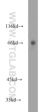 MTMR2 Antibody in Western Blot (WB)