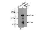 BMPR2 Antibody in Immunoprecipitation (IP)