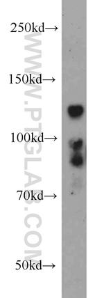 BMPR2 Antibody in Western Blot (WB)