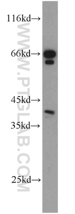 PON2 Antibody in Western Blot (WB)