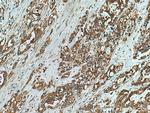 NIT1 Antibody in Immunohistochemistry (Paraffin) (IHC (P))