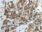 NIT1 Antibody in Immunohistochemistry (Paraffin) (IHC (P))