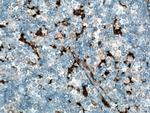 Fascin Antibody in Immunohistochemistry (Paraffin) (IHC (P))