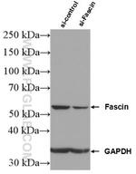 Fascin Antibody in Western Blot (WB)