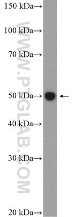 Fascin Antibody in Western Blot (WB)