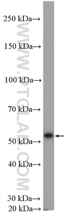 Fascin Antibody in Western Blot (WB)