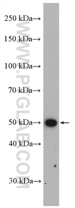 Fascin Antibody in Western Blot (WB)