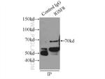 IGSF8 Antibody in Immunoprecipitation (IP)