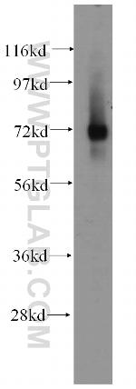 IGSF8 Antibody in Western Blot (WB)