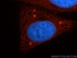 Casein Kinase 1 delta Antibody in Immunocytochemistry (ICC/IF)