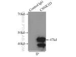 Casein Kinase 1 delta Antibody in Immunoprecipitation (IP)