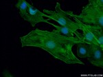 ACTA2/smooth muscle actin Antibody in Immunocytochemistry (ICC/IF)