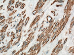 ACTA2/smooth muscle actin Antibody in Immunohistochemistry (Paraffin) (IHC (P))