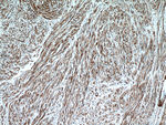 ACTA2/smooth muscle actin Antibody in Immunohistochemistry (Paraffin) (IHC (P))