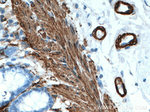 ACTA2/smooth muscle actin Antibody in Immunohistochemistry (Paraffin) (IHC (P))