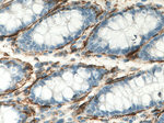 ACTA2/smooth muscle actin Antibody in Immunohistochemistry (Paraffin) (IHC (P))