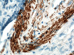 ACTA2/smooth muscle actin Antibody in Immunohistochemistry (Paraffin) (IHC (P))