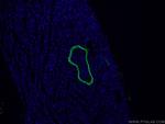 ACTA2/smooth muscle actin Antibody in Immunohistochemistry (PFA fixed) (IHC (PFA))