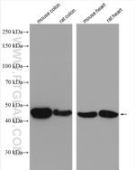 ACTA2/smooth muscle actin Antibody in Western Blot (WB)