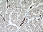 ACTA2/smooth muscle actin Antibody in Immunohistochemistry (Paraffin) (IHC (P))