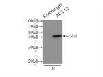 ACTA2/smooth muscle actin Antibody in Immunoprecipitation (IP)