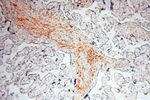 CLCNKA Antibody in Immunohistochemistry (Paraffin) (IHC (P))