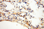 CLCNKA Antibody in Immunohistochemistry (Paraffin) (IHC (P))