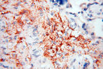 CLCNKA Antibody in Immunohistochemistry (Paraffin) (IHC (P))