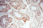 CLCNKA Antibody in Immunohistochemistry (Paraffin) (IHC (P))