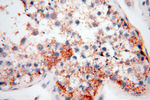 CLCNKA Antibody in Immunohistochemistry (Paraffin) (IHC (P))