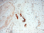 CLCNKA Antibody in Immunohistochemistry (Paraffin) (IHC (P))