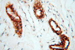 CLCNKA Antibody in Immunohistochemistry (Paraffin) (IHC (P))