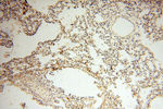 CLCNKA Antibody in Immunohistochemistry (Paraffin) (IHC (P))